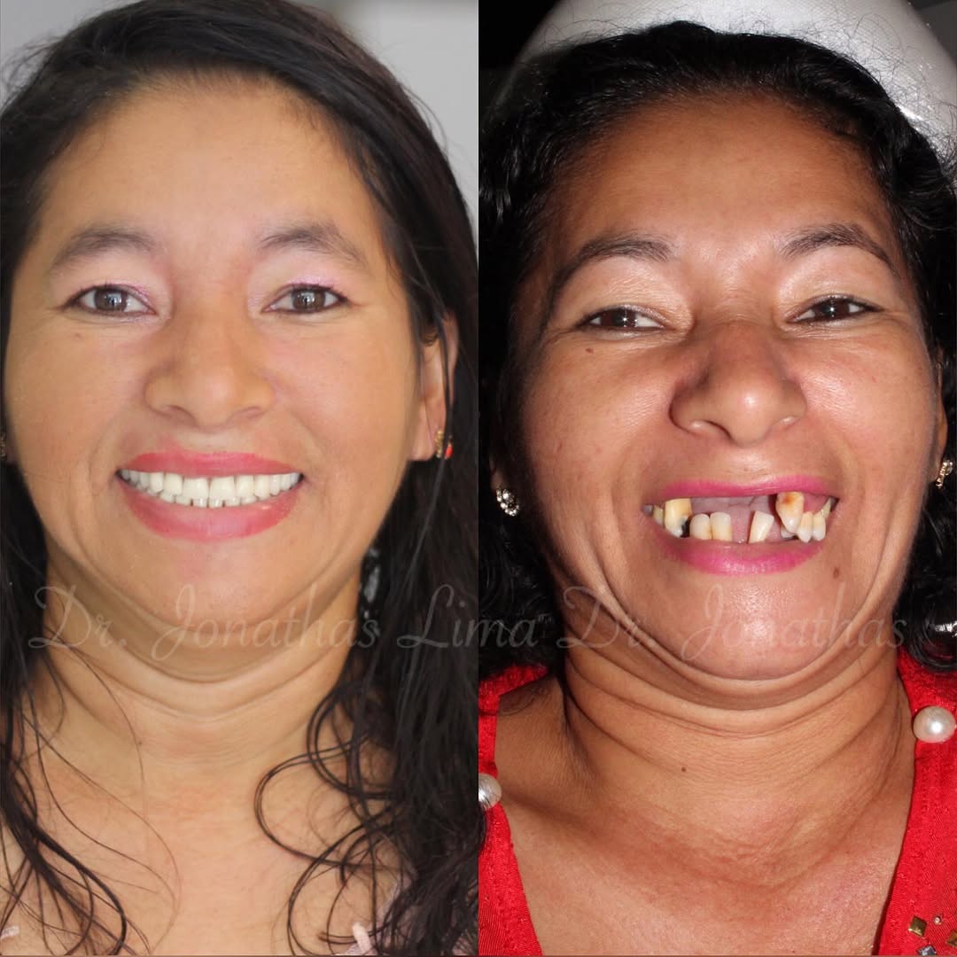 89278142_189049785708356_8390149331426235776_n